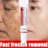 Zoo-Son (Original) Whitening Freckle Cream
