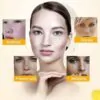 Zoo-Son (Original) Whitening Freckle Cream