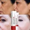Zoo-Son (Original) Whitening Freckle Cream