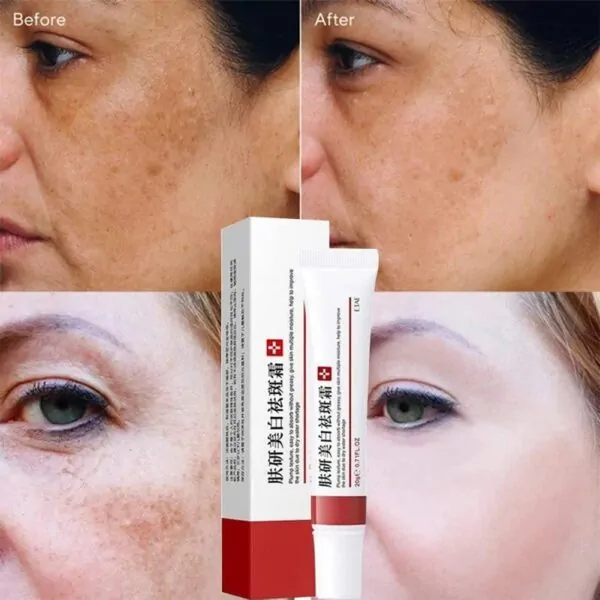 Zoo-Son (Original) Whitening Freckle Cream