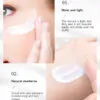 Whitening Freckle Cream, Acne Scar Removal Treatment, Pigmentation Removal, Remove Dark Spots