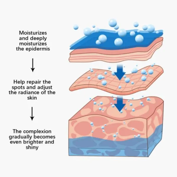 Whitening Freckle Cream, Acne Scar Removal Treatment, Pigmentation Removal, Remove Dark Spots
