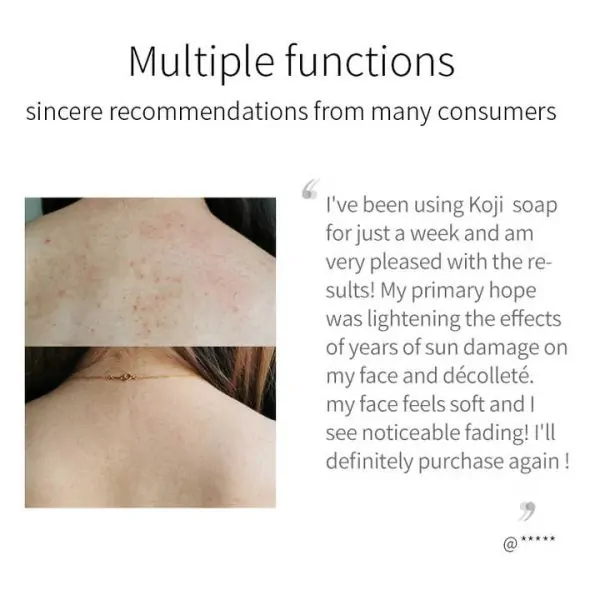 Kojic Acid Skin Lightening Soap