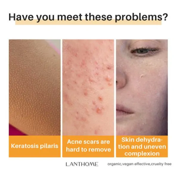 Kojic Acid Skin Lightening Soap