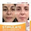 Zoo-Son (Original) Whitening Freckle Cream