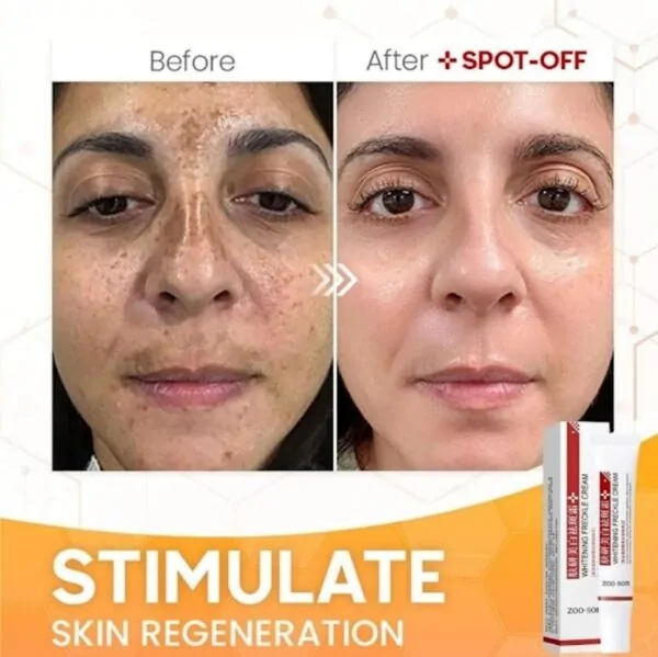 Zoo-Son (Original) Whitening Freckle Cream