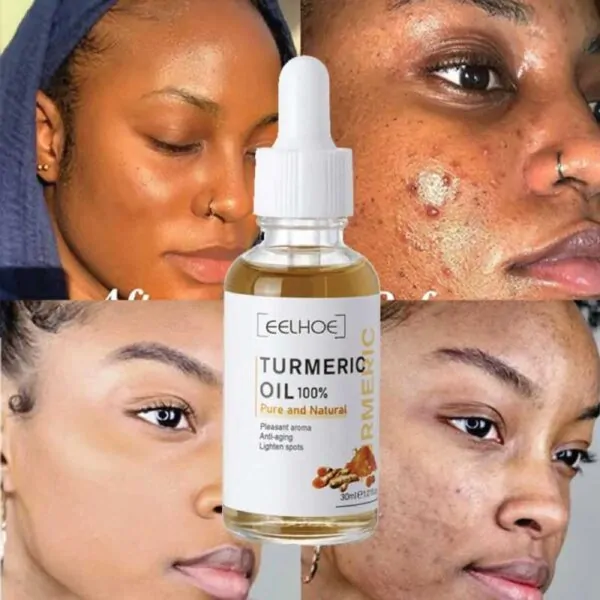 EELHOE Turmeric Oil EELHOE Turmeric Oil