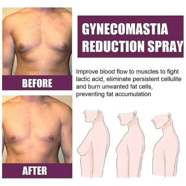 Gynecomastia Reduction Spray – Six-pack Shaper Spray Gynecomastia Reduction Spray – Six-pack Shaper Spray